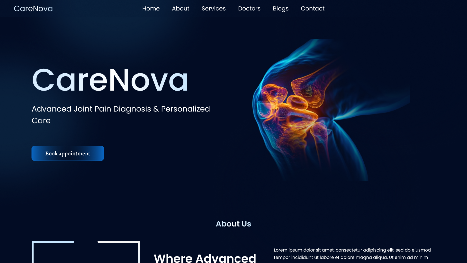CareNova website homepage for advanced joint pain diagnosis